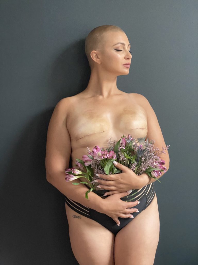 Girl holding flowers after mastectomy