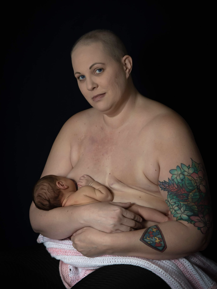 Breast cancer while pregnant