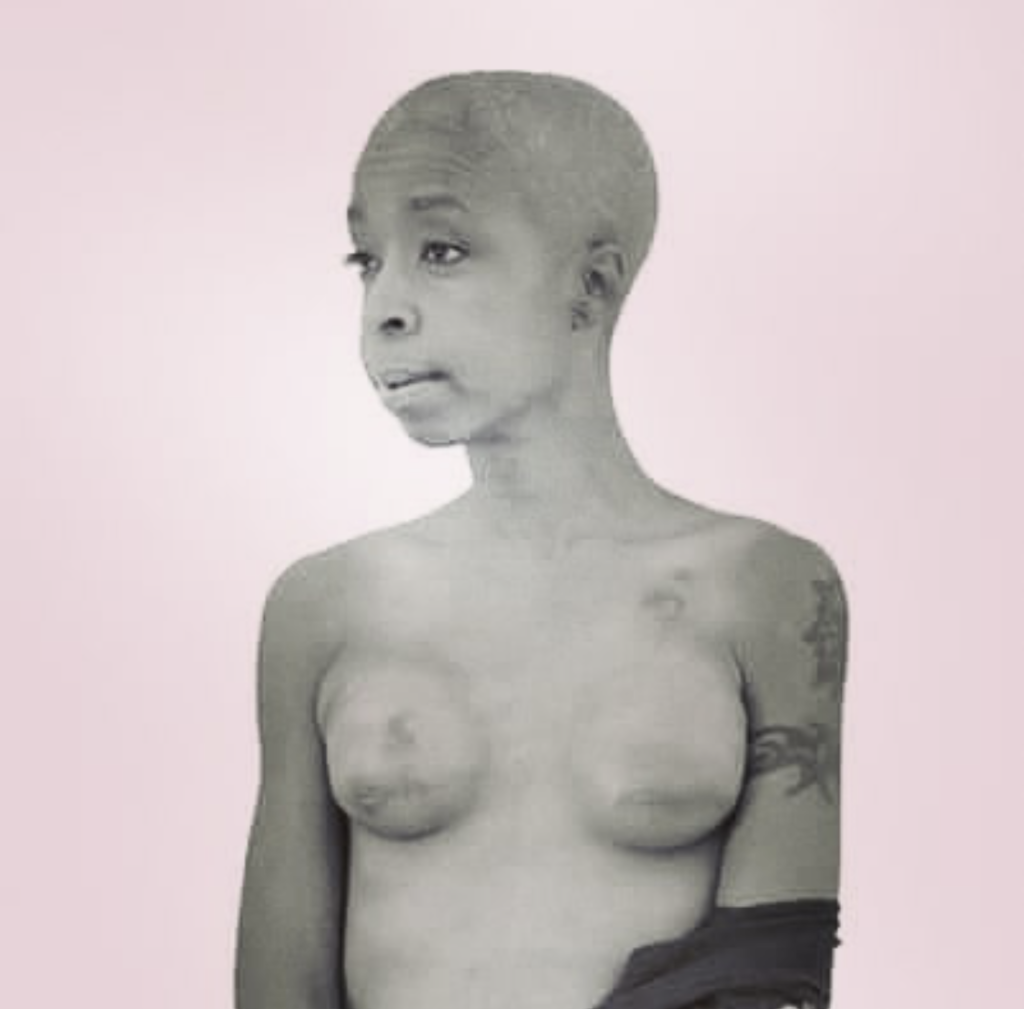 breastcancersurvivor