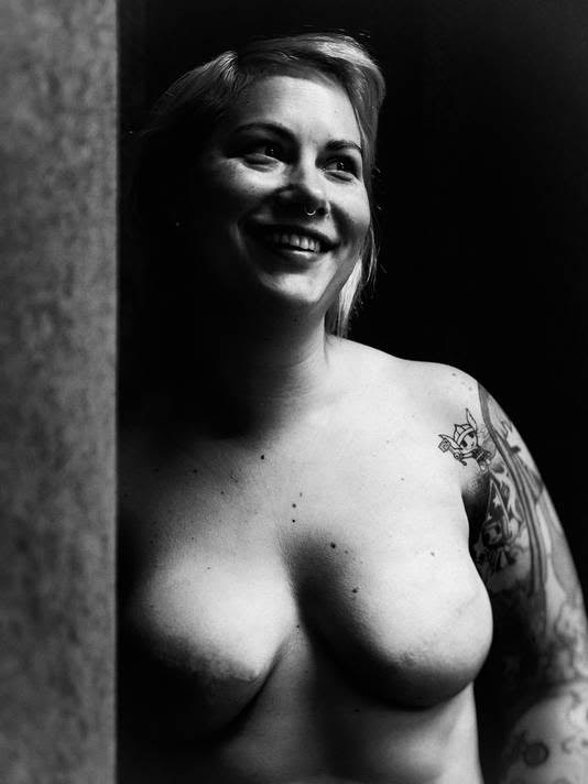 Smiling after mastectomy implants