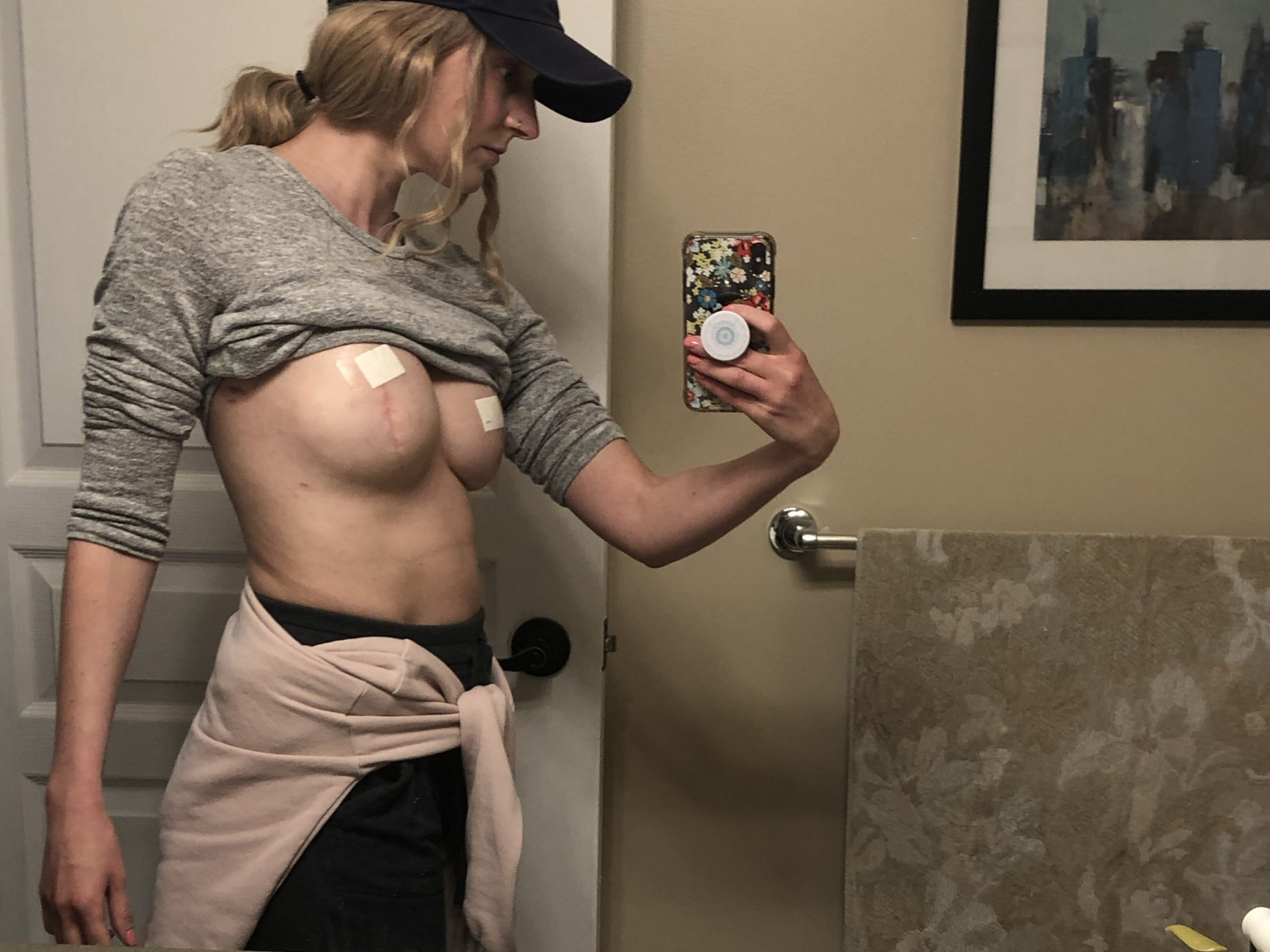 Post mastectomy op selfie